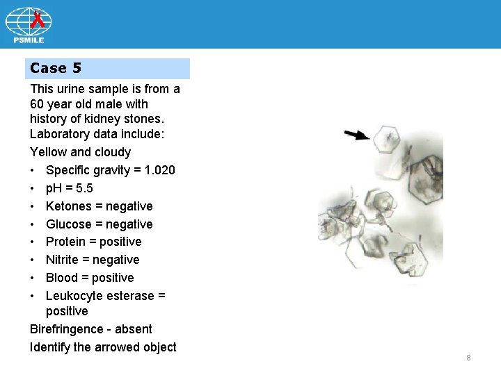 Case 5 This urine sample is from a 60 year old male with history