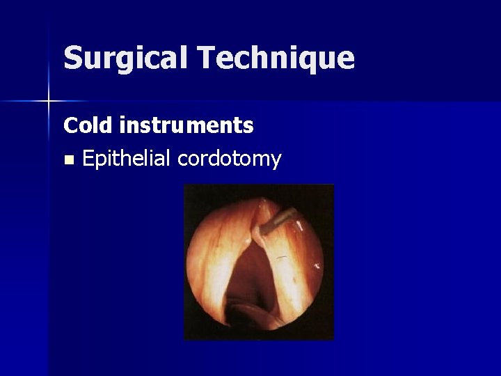 Surgical Technique Cold instruments n Epithelial cordotomy 