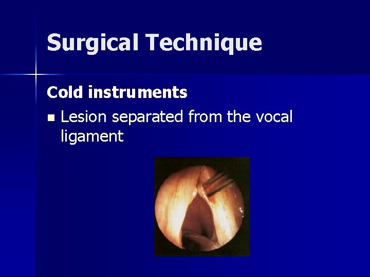 Surgical Technique Cold instruments n Lesion separated from the vocal ligament 