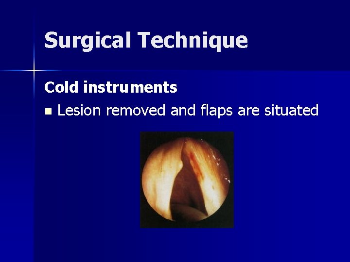 Surgical Technique Cold instruments n Lesion removed and flaps are situated 