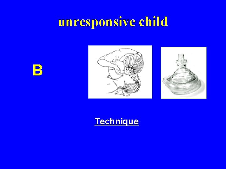 unresponsive child B Technique 