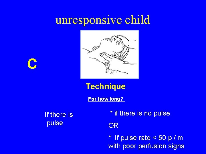 unresponsive child C Technique For how long? If there is pulse * if there