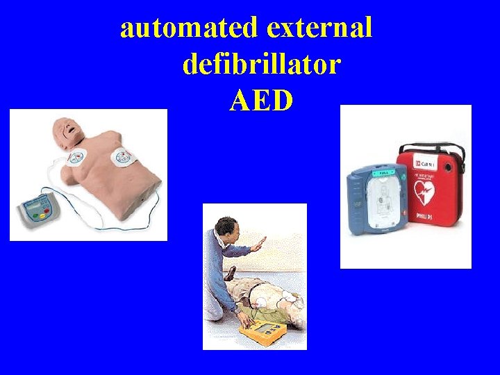 automated external defibrillator AED 