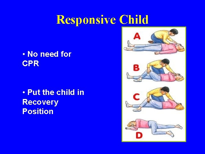 Responsive Child • No need for CPR • Put the child in Recovery Position