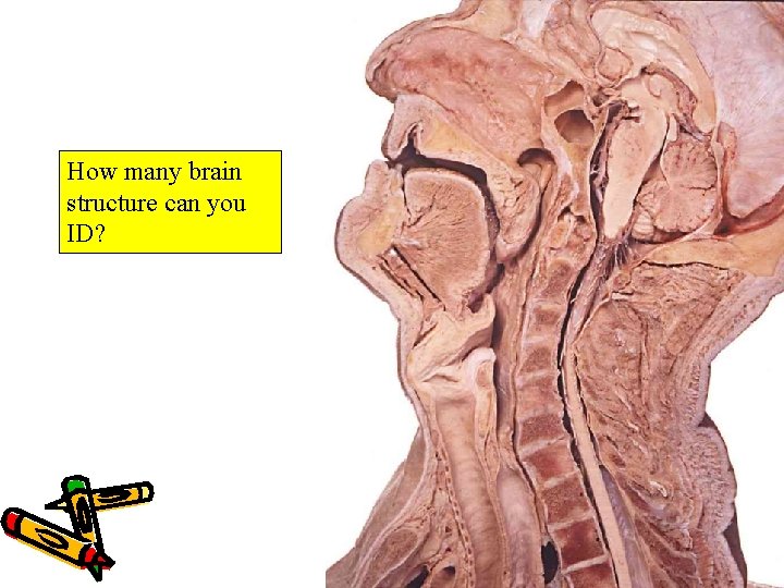 How many brain structure can you ID? 