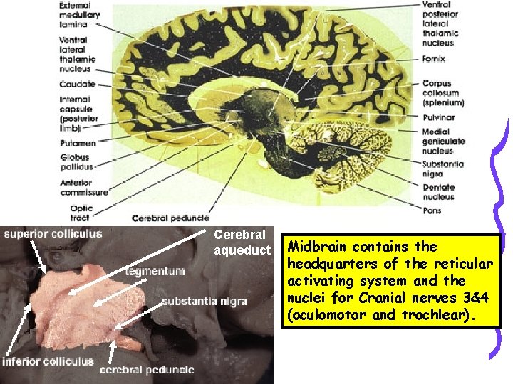 Cerebral aqueduct Midbrain contains the headquarters of the reticular activating system and the nuclei