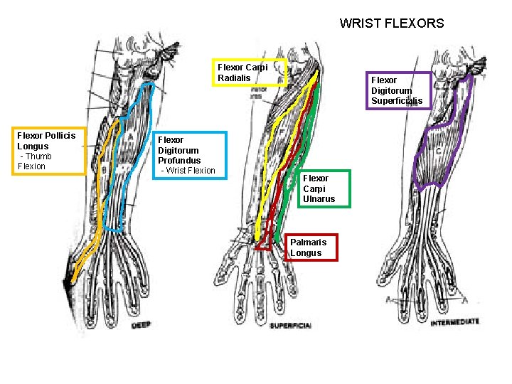 WRIST FLEXORS Flexor Carpi Radialis Flexor Pollicis Longus - Thumb Flexion Flexor Digitorum Profundus