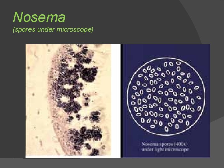 Nosema (spores under microscope) 