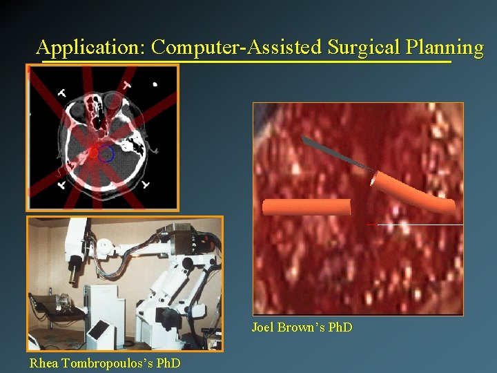 Application: Computer-Assisted Surgical Planning Joel Brown’s Ph. D Rhea Tombropoulos’s Ph. D 