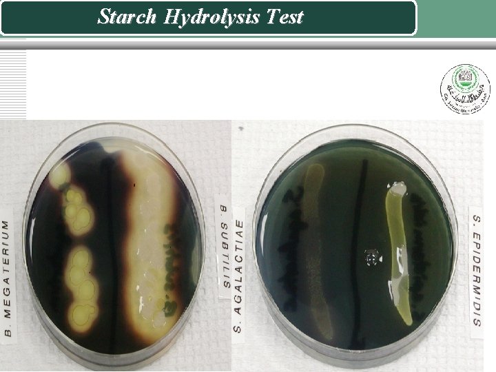 Starch Hydrolysis Test 