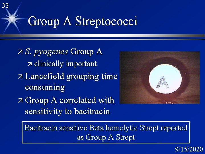 32 Group A Streptococci ä S. pyogenes Group A ä clinically important ä Lancefield
