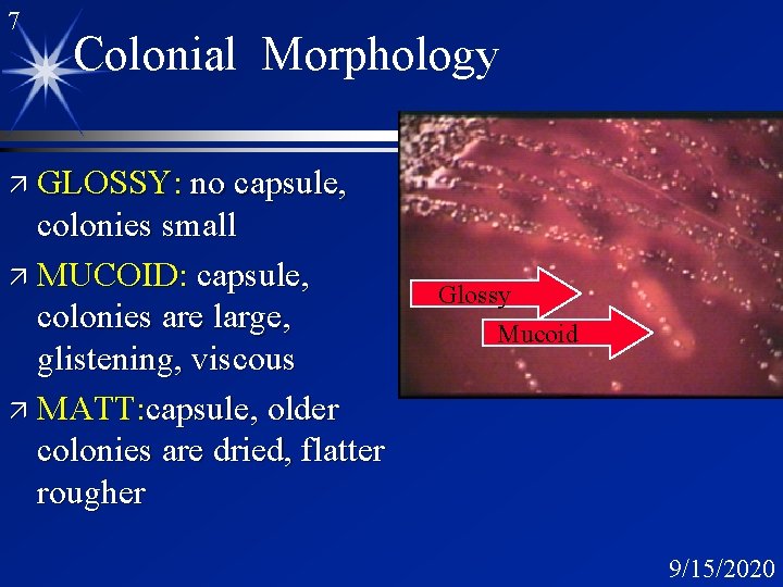 7 Colonial Morphology ä GLOSSY: no capsule, colonies small ä MUCOID: capsule, colonies are