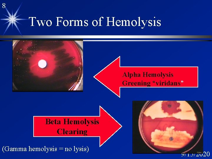 8 Two Forms of Hemolysis Alpha Hemolysis Greening “viridans” Beta Hemolysis Clearing (Gamma hemolysis