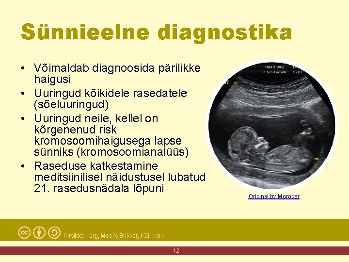 Sünnieelne diagnostika • Võimaldab diagnoosida pärilikke haigusi • Uuringud kõikidele rasedatele (sõeluuringud) • Uuringud