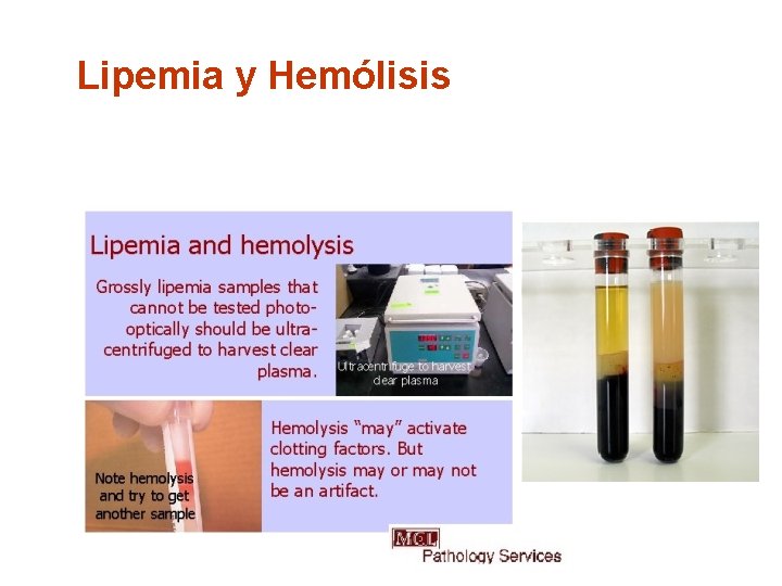 Lipemia y Hemólisis 