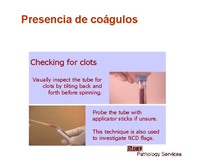 Presencia de coágulos 