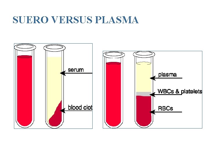 SUERO VERSUS PLASMA 