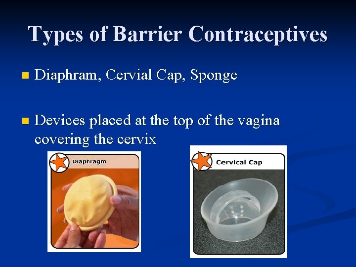 Types of Barrier Contraceptives n Diaphram, Cervial Cap, Sponge n Devices placed at the