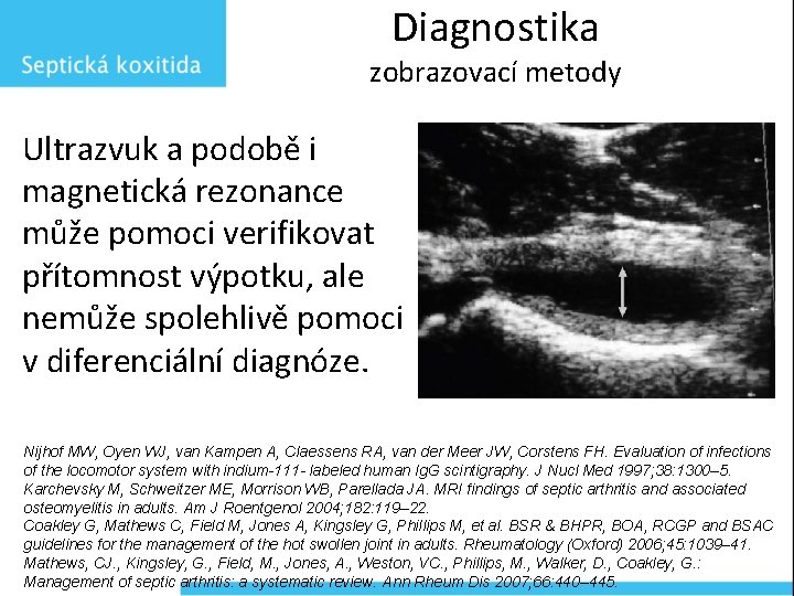 Diagnostika zobrazovací metody Ultrazvuk a podobě i magnetická rezonance může pomoci verifikovat přítomnost výpotku,