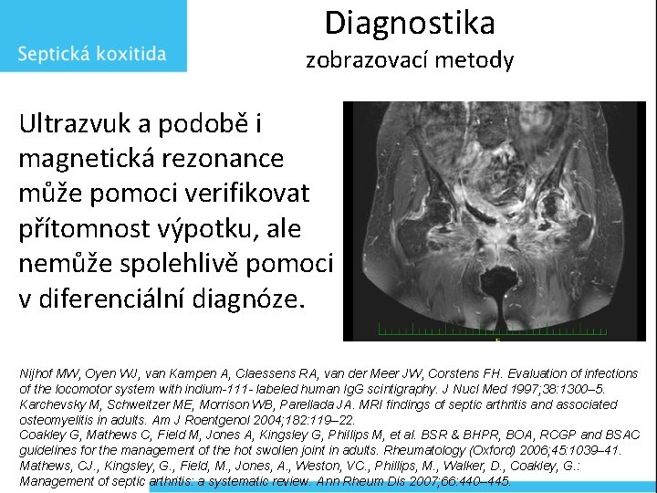 Diagnostika zobrazovací metody Ultrazvuk a podobě i magnetická rezonance může pomoci verifikovat přítomnost výpotku,