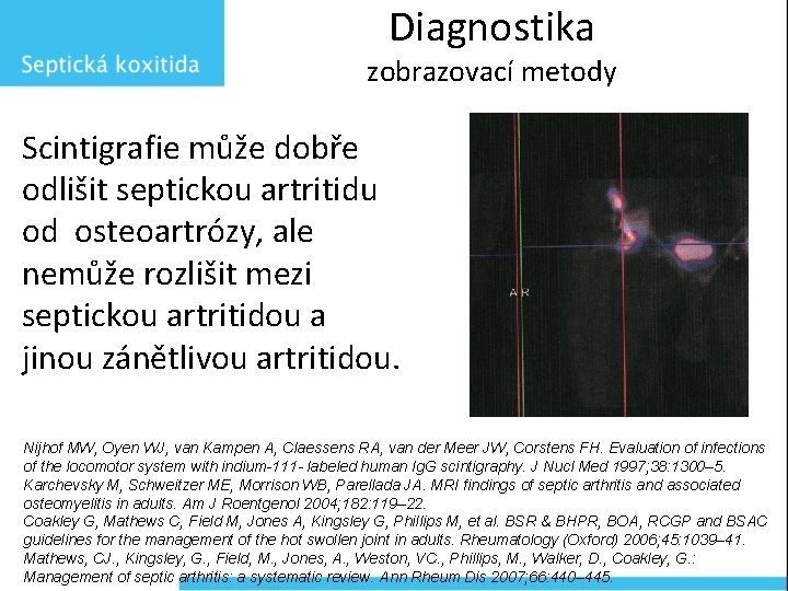 Diagnostika zobrazovací metody Scintigrafie může dobře odlišit septickou artritidu od osteoartrózy, ale nemůže rozlišit