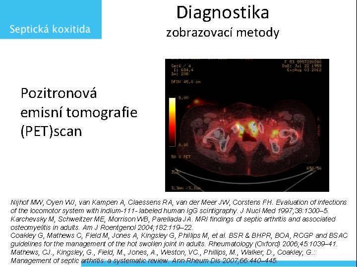 Diagnostika zobrazovací metody Pozitronová emisní tomografie (PET)scan Nijhof MW, Oyen WJ, van Kampen A,