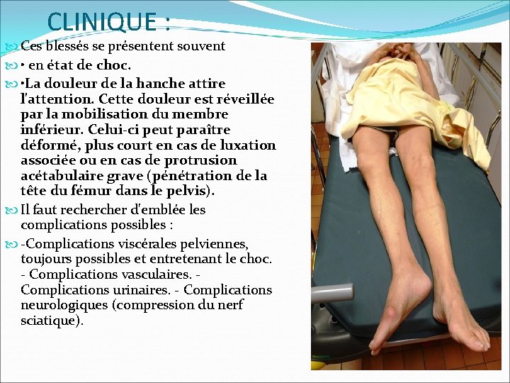 CLINIQUE : Ces blessés se présentent souvent • en état de choc. • La