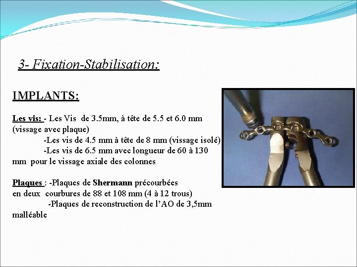 3 - Fixation-Stabilisation: IMPLANTS: Les vis: - Les Vis de 3. 5 mm, à