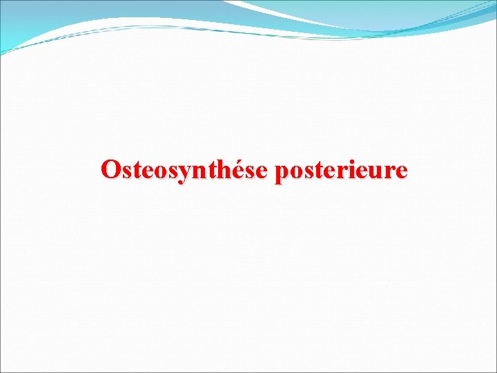 Osteosynthése posterieure 