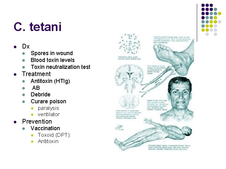 C. tetani l Dx l l Spores in wound Blood toxin levels Toxin neutralization