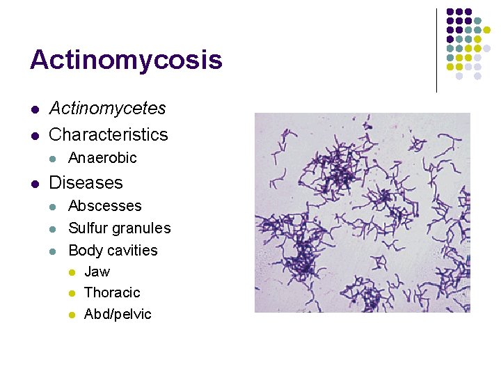 Actinomycosis l l Actinomycetes Characteristics l l Anaerobic Diseases l l l Abscesses Sulfur