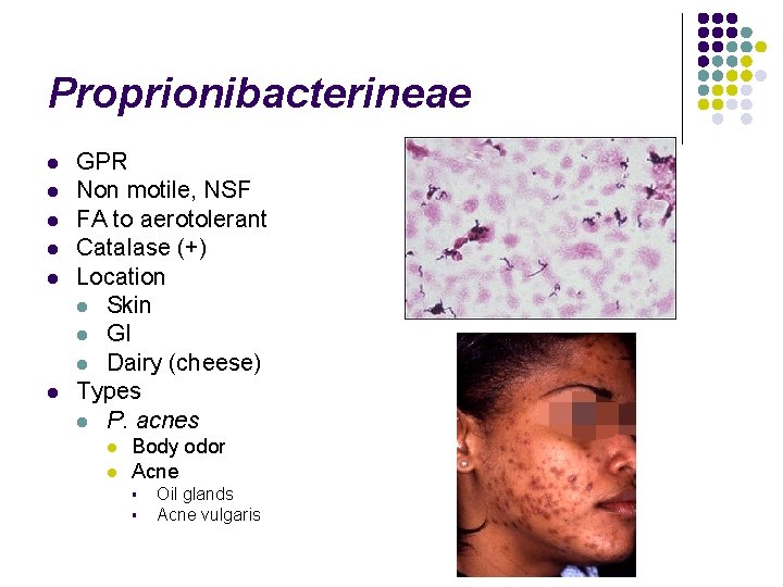 Proprionibacterineae l l l GPR Non motile, NSF FA to aerotolerant Catalase (+) Location