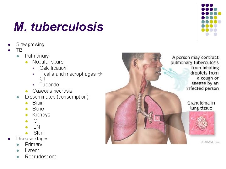 M. tuberculosis l l Slow growing TB l l l Pulmonary l Nodular scars