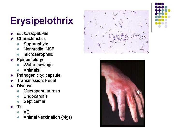 Erysipelothrix l l l l E. rhusiopathiae Characteristics l Saphrophyte l Nonmotile, NSF l