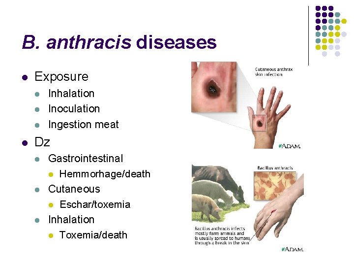 B. anthracis diseases l Exposure l l Inhalation Inoculation Ingestion meat Dz l l