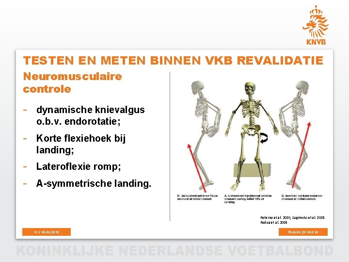 TESTEN EN METEN BINNEN VKB REVALIDATIE Neuromusculaire controle - dynamische knievalgus o. b. v.