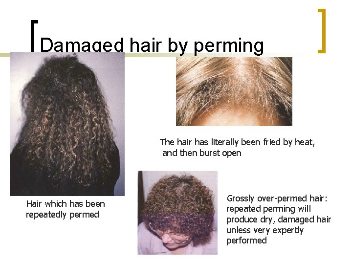 Damaged hair by perming The hair has literally been fried by heat, and then