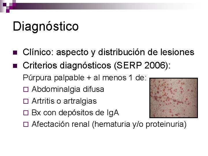 Diagnóstico n n Clínico: aspecto y distribución de lesiones Criterios diagnósticos (SERP 2006): Púrpura