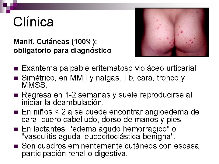 Clínica Manif. Cutáneas (100%): obligatorio para diagnóstico n n n Exantema palpable eritematoso violáceo