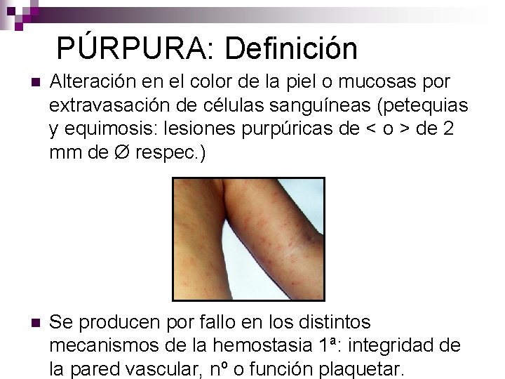 PÚRPURA: Definición n Alteración en el color de la piel o mucosas por extravasación