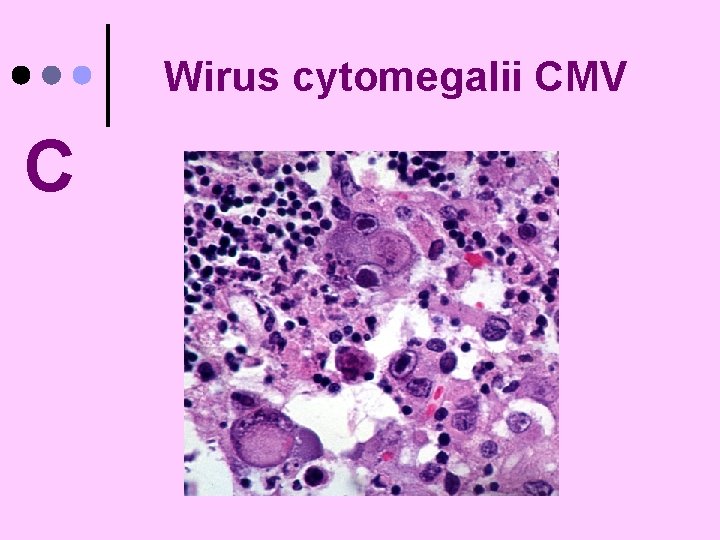 Wirus cytomegalii CMV C 