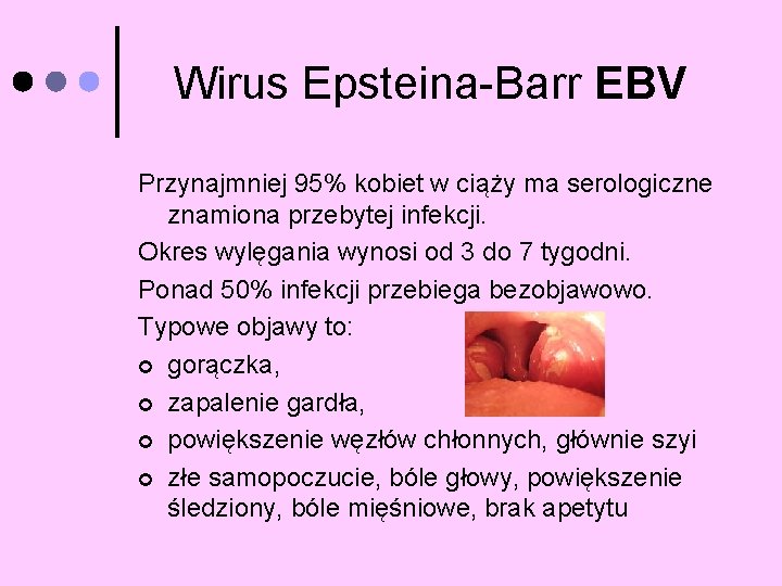 Wirus Epsteina-Barr EBV Przynajmniej 95% kobiet w ciąży ma serologiczne znamiona przebytej infekcji. Okres