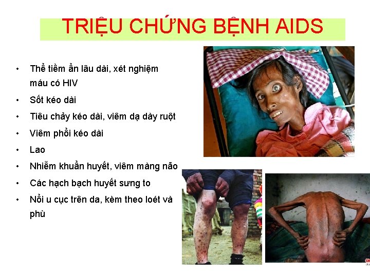 TRIỆU CHỨNG BỆNH AIDS • Thể tiềm ẩn lâu dài, xét nghiệm máu có