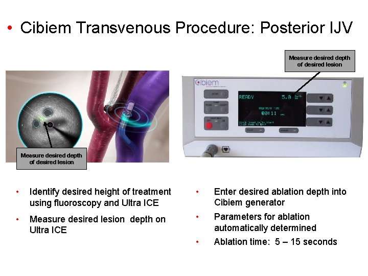  • Cibiem Transvenous Procedure: Posterior IJV Measure desired depth of desired lesion •