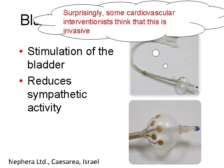 Surprisingly, some cardiovascular interventionists think that this is invasive Bladder Trigone Stimulation • Stimulation