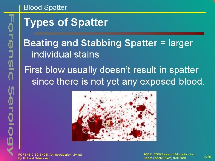 Blood Spatter Types of Spatter Beating and Stabbing Spatter = larger individual stains First