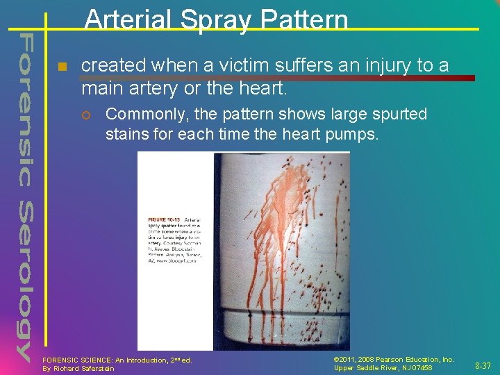 Arterial Spray Pattern n created when a victim suffers an injury to a main Arterial Spray Pattern n created when a victim suffers an injury to a main