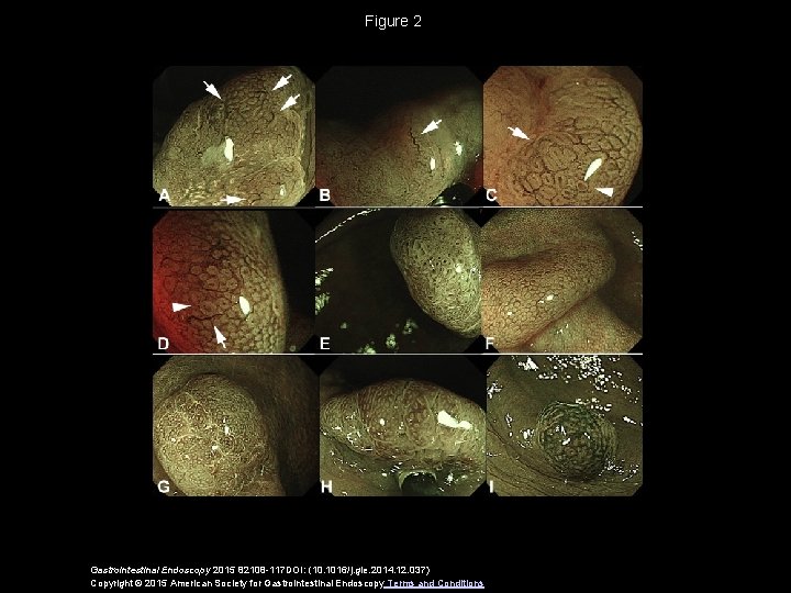 Figure 2 Gastrointestinal Endoscopy 2015 82108 -117 DOI: (10. 1016/j. gie. 2014. 12. 037)