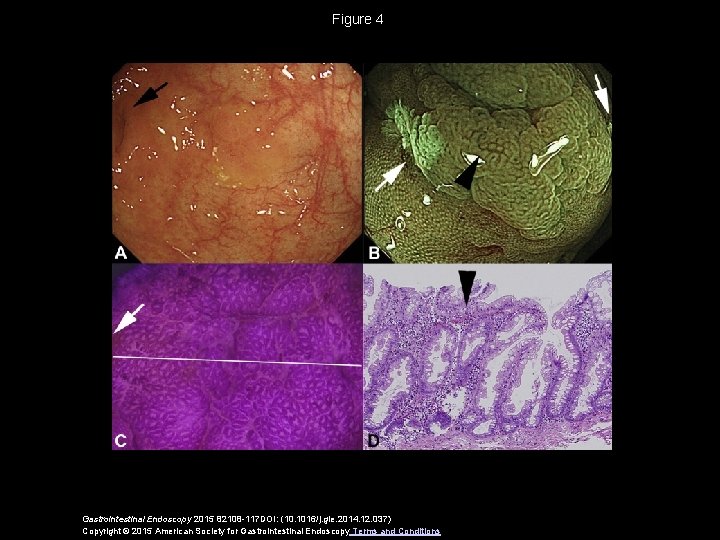 Figure 4 Gastrointestinal Endoscopy 2015 82108 -117 DOI: (10. 1016/j. gie. 2014. 12. 037)