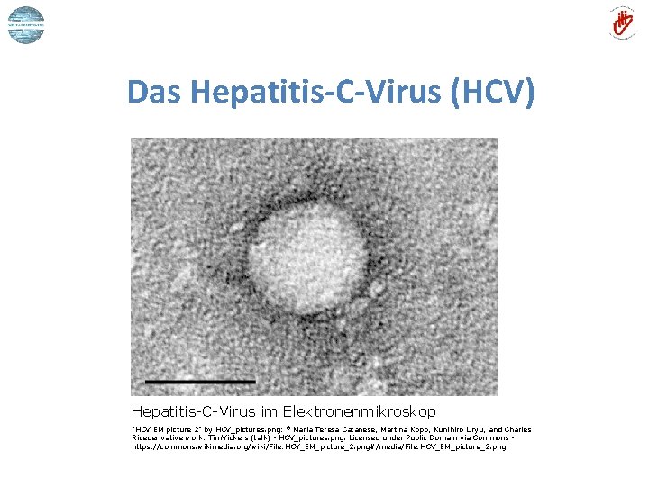 Das Hepatitis-C-Virus (HCV) Hepatitis-C-Virus im Elektronenmikroskop "HCV EM picture 2" by HCV_pictures. png: ©